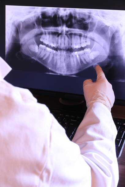 Best Root Canal Emergency Dentist  in Sugar Land, TX