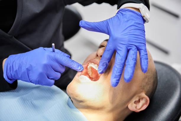 Best Dentist for Tooth Abscess  in Sugar Land, TX